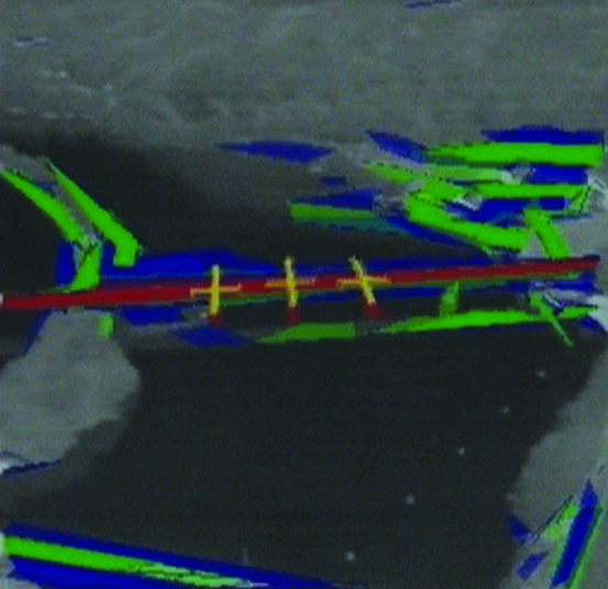 A computer vision view of a landscape, possibly of a bridge with red, blue, green, and yellow colours marking landscape features.