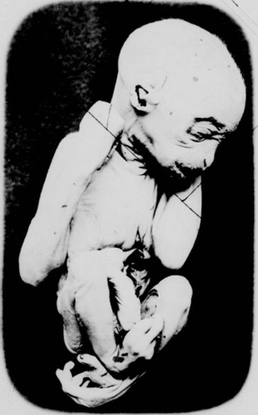 Black-and-white photograph of an orangutan fetus. Being hairless is closely resembles a human fetus, save for the structure of its feet.
