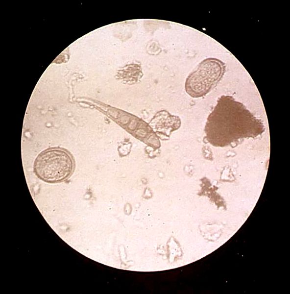 A scientific photograph that shows different microscopic corpuscles of different shapes inside a circular view.